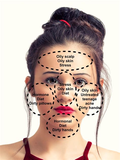 Face Mapping: The Location of Your Break Outs Can Reveal the Cause ...