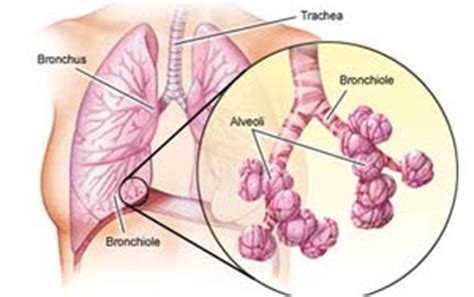 Lung Biopsy – Laparoscopic, thoracoscopic and hernia surgery