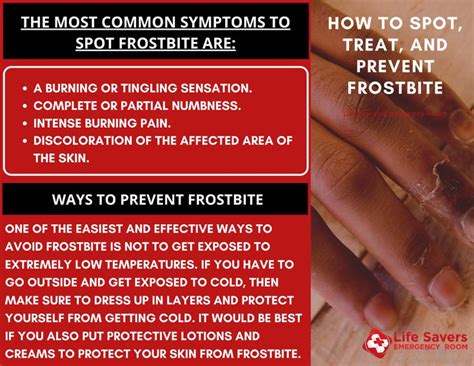 How to Spot, Treat, and Prevent Frostbite in 2020 (With images) | Life savers, Prevention ...