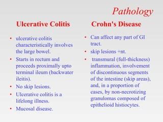 IBD Uicerative colitis versus crohn's disease.pptx