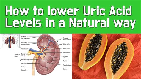 How to lower Uric Acid Levels in a Natural way - YouTube