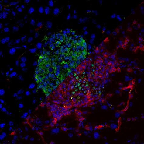 Keeping killer T cells in check | eLife Science Digests | eLife