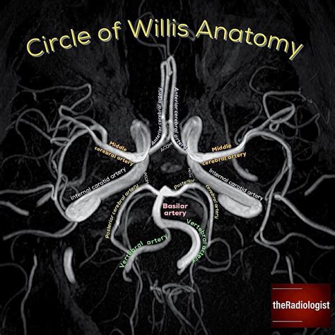 👨🏽‍💻Need a refresher on Circle of Willis anatomy? Check out this image ...