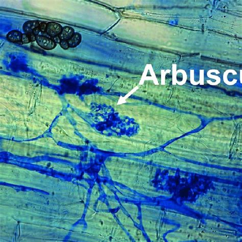 Stained arbuscular myccorhizal fungi in a plant cell. Photo by Luise ...