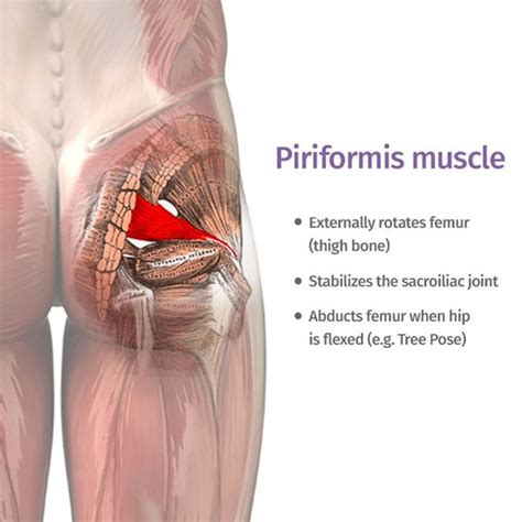 Piriformis Syndrome Pain Pattern