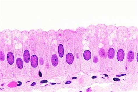 Tipos de epitelios: ¿Cómo se clasifica el tejido epitelial? - Curiosoando