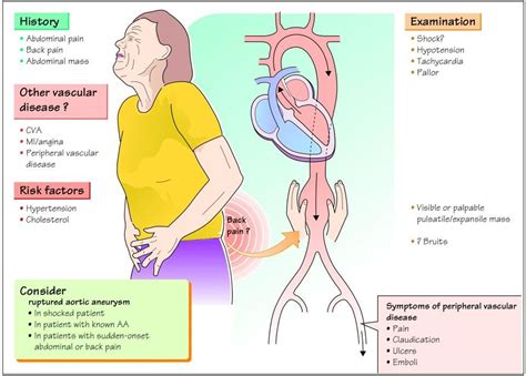 Aortic Aneurysm - Cardiac Nursing School | Aortic aneurysm, Abdominal aortic aneurysm, Cardiac ...