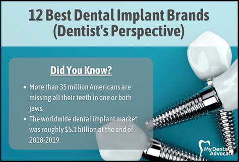 Best Dental Implant Brands (Full Review)