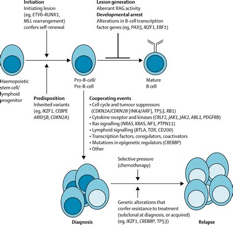 Acute lymphoblastic leukaemia - The Lancet