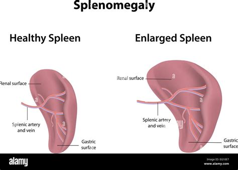 How Long Can A Dog Live With Enlarged Spleen