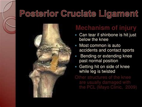 Injuries to ACL, PCL, and MCL