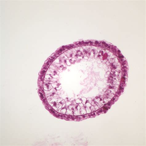 Hydra Nematocysts Slide