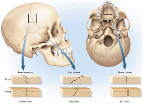 What Are Bone Sutures