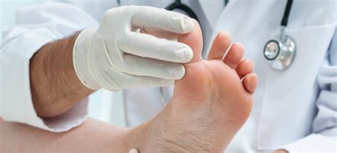 Broken vs. Sprained Toe: How to Tell the Difference - The Emergency Clinic