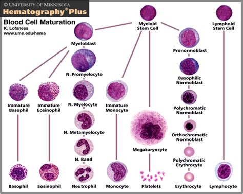 Chronic myelogenous leukemia-CML - Am-Medicine