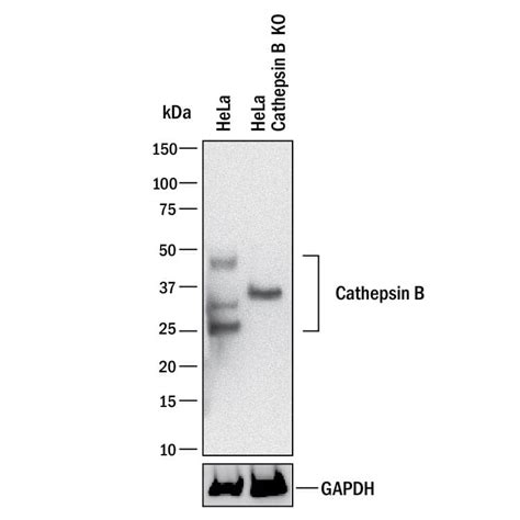 Cathepsin B Antibodies: Novus Biologicals