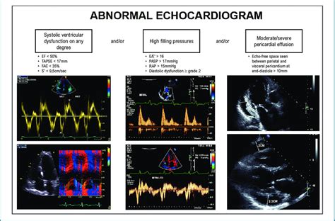 -Criteria for abnormal echocardiogram. TAPSE: tricuspid annular plane ...