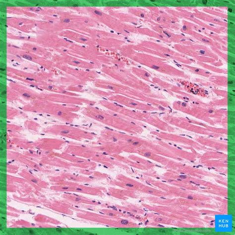 Cardiac tissue - Histology | Kenhub