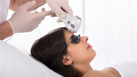 Widow's peak and laser hair removal to get rid of it