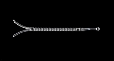 Spirox Announces Positive Clinical Study Results For LATERA Implant ...