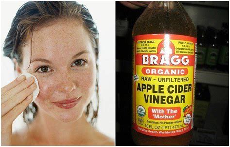 5 Reasons To Wash Your Face With Apple Cider Vinegar - and about that "worse carb" to eat after ...