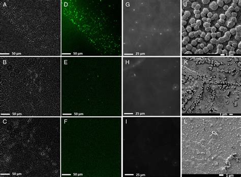 Standard GBS, GBS positive and GBS negative clinical samples imaged by ...