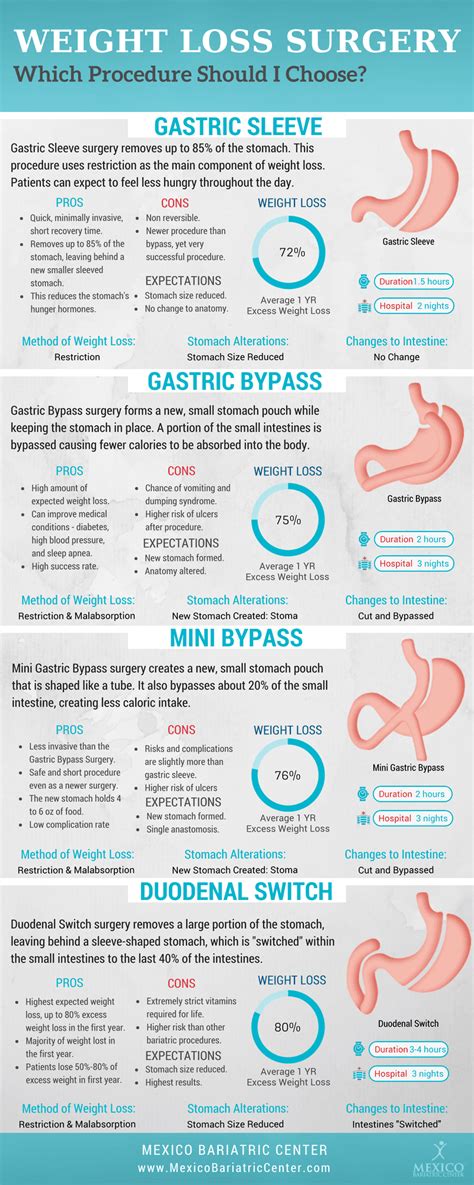 15 Clever Types Of Weight Loss Surgery - Best Product Reviews