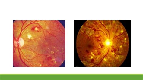 Fundus examination