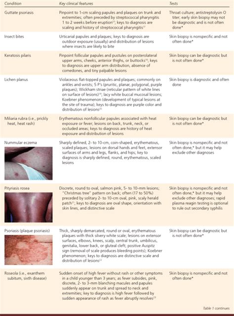 [PDF] The generalized rash: part I. Differential diagnosis. | Semantic Scholar