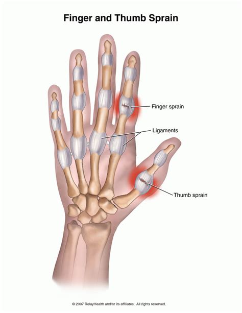 thumb | Singapore Orthopaedic Surgeon | Neurosurgeon | Gleneagles Hospital