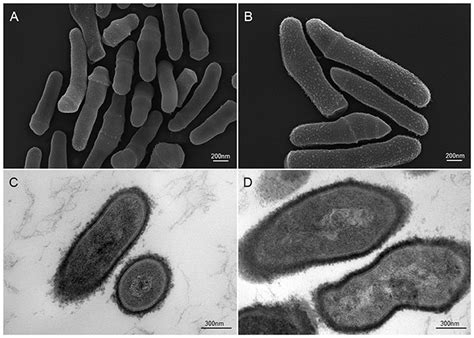 Cutibacterium Acnes