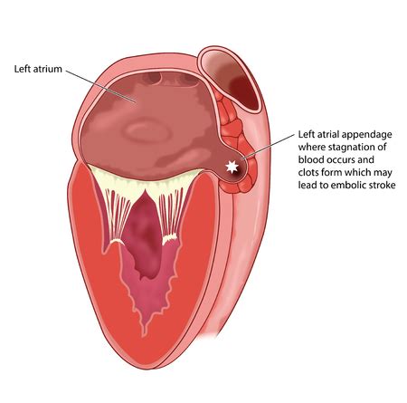 Vector of Section through heart showing - ID:92762623 - Royalty Free Image - Stocklib