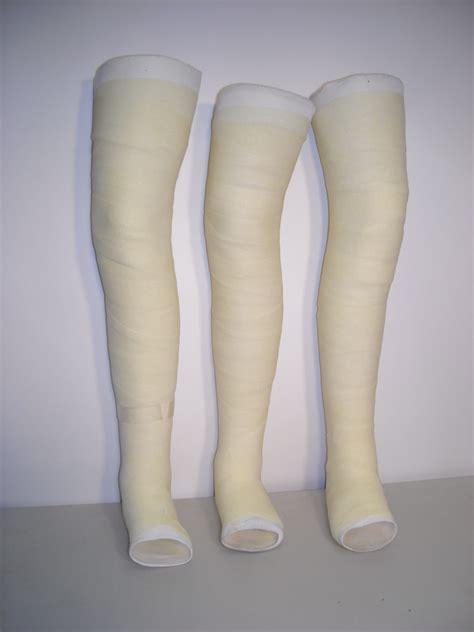 Plaster cast (leg) - Prop Hire and Deliver