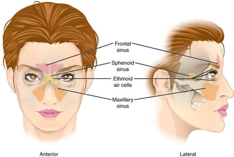 Sinus Headache - Symptoms, Causes And Management