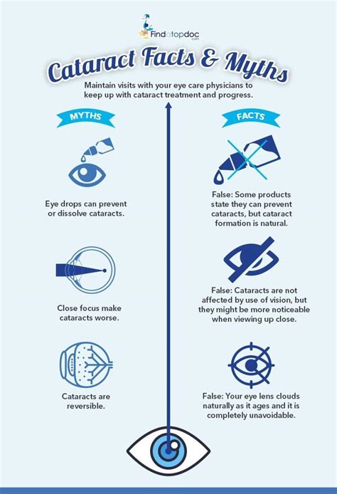 How To Prevent A Cataract - Birthrepresentative14