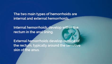 Hemorrhoids & Pregnancy - HemorrhoidAnswers