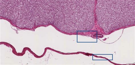 WEEK 11 - histology of the NS II - meninges and PNS Flashcards | Quizlet