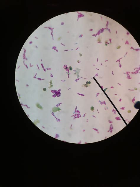 E. Coli Under The Microscope - Biology Notes Online