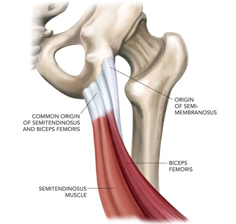 A Pain in the Butt? Understanding Proximal Hamstring Tendinopathy and what you can do about it ...