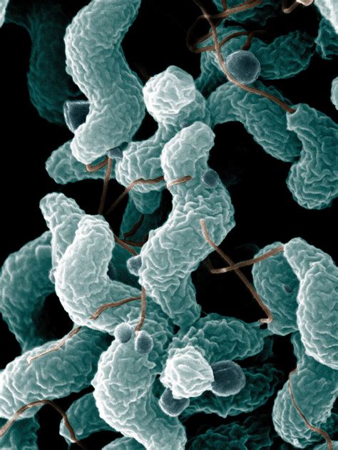 Bacteria | Free Stock Photo | Campylobacter bacteria as seen from an electron microscope | # 10072