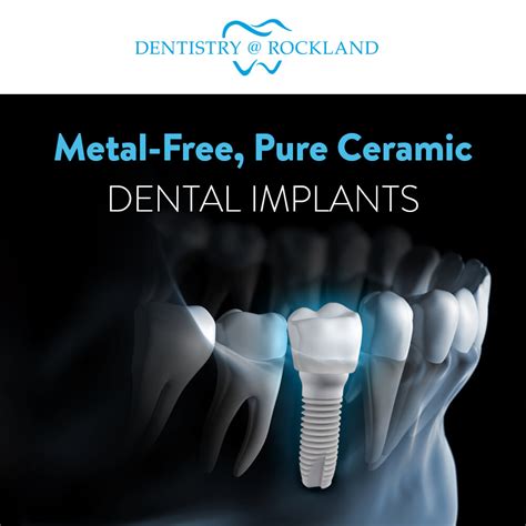 What are Ceramic Dental Implants and are they good for you? - Dentistry @ Rockland - Dentist ...