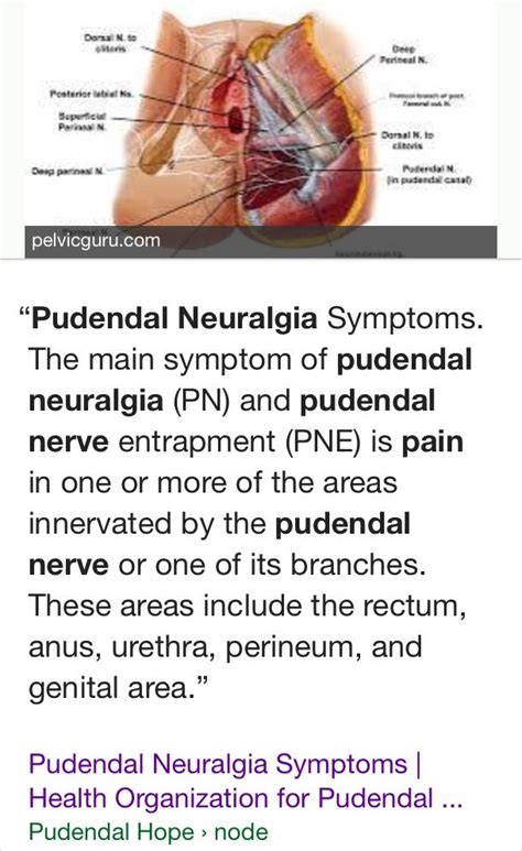 Pin on Pudendal Nerve