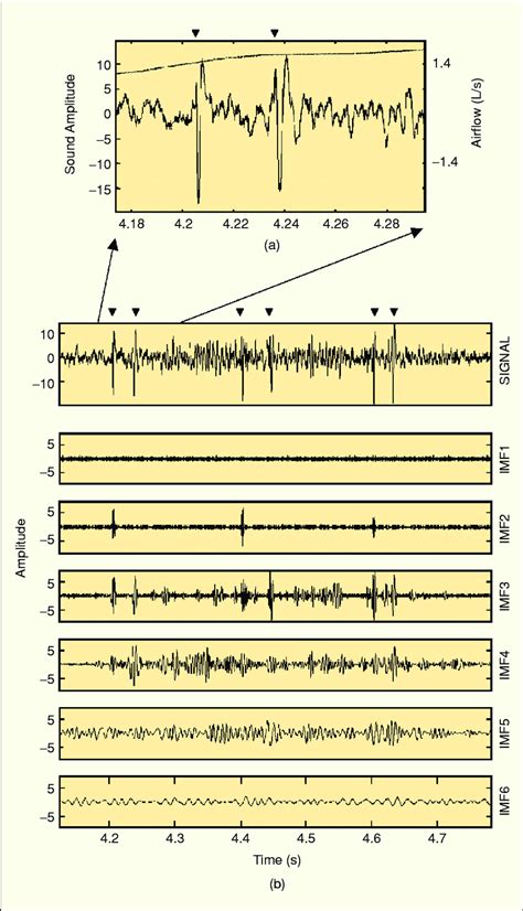 Combination of fine and coarse crackles at SNR around 10 dB. (a) Time... | Download Scientific ...