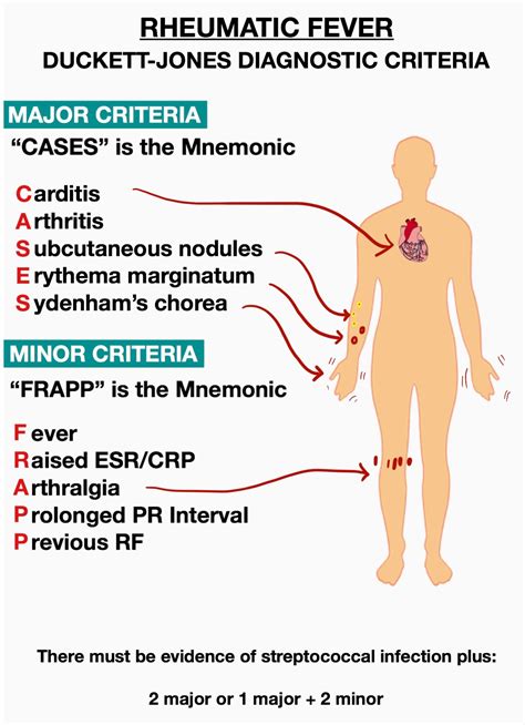 Rheumatic Fever Diagnostic Criteria Mnemonics | Medical Junction