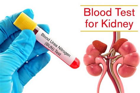 What Does A Kidney Function Test Mean And How Do I Read An Index?