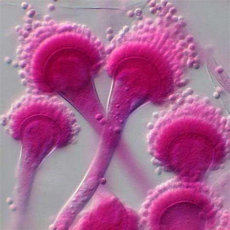 Aspergillus fumigatus