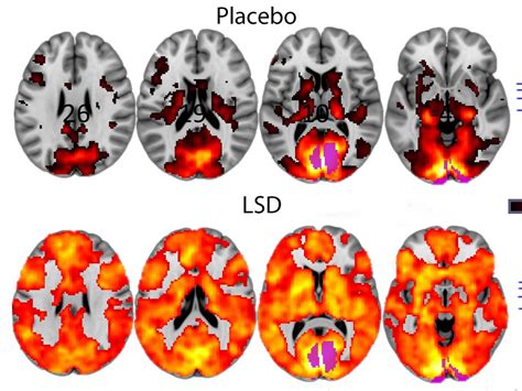 New studies just found psychedelics help terminal cancer patients and ...