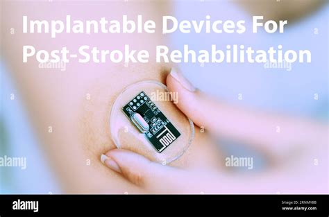 Implantable devices for post-stroke rehabilitation: Devices that ...