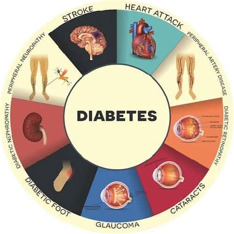 Diabetes Mellitus Type 2: Symptoms, Complications, and Treatment