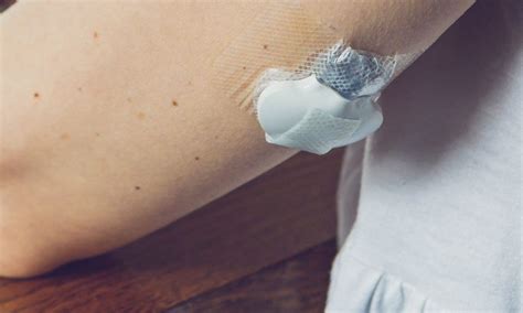 Insulin Patch - How The Insulin Patch Works, Challenges, Research